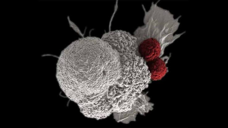Children account for 7.2% of cancer cases in Nigeria – Official